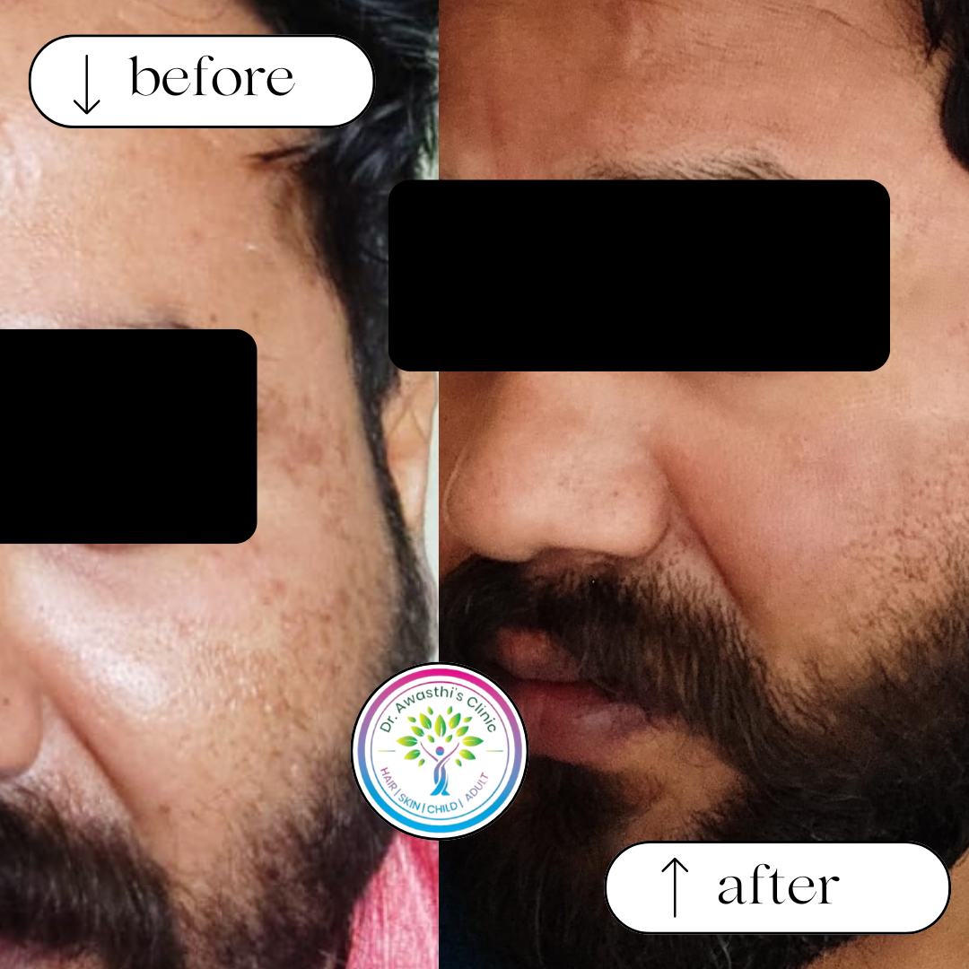 beige white minimalist beauty skincare before after collage instagram post (1)