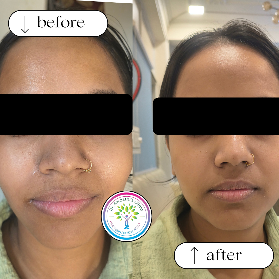 beige white minimalist beauty skincare before after collage instagram post (2)