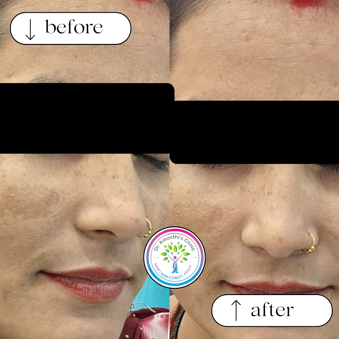 beige white minimalist beauty skincare before after collage instagram post (3)