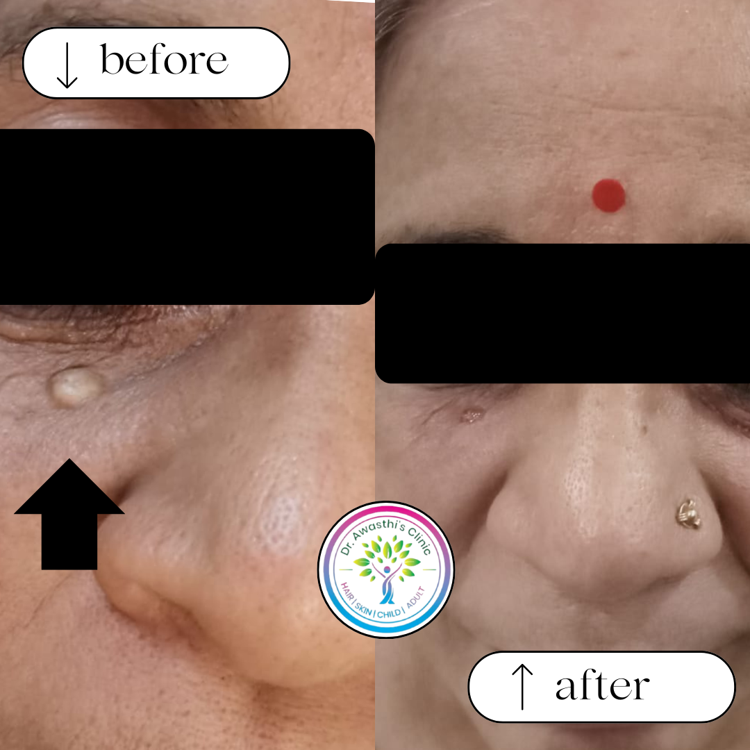 beige white minimalist beauty skincare before after collage instagram post (4)