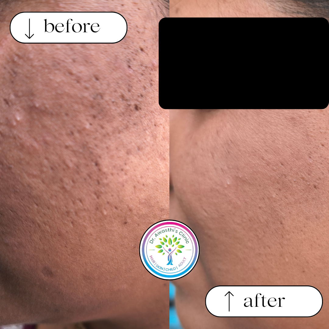 beige white minimalist beauty skincare before after collage instagram post (5)