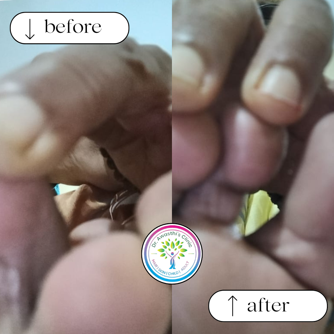 beige white minimalist beauty skincare before after collage instagram post (6)