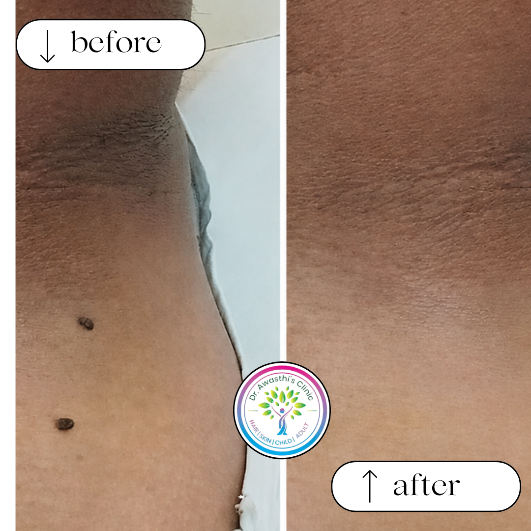 beige white minimalist beauty skincare before after collage instagram post (7)