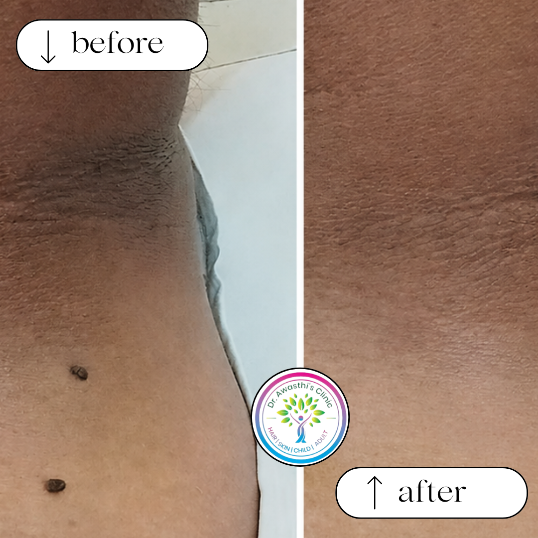 beige white minimalist beauty skincare before after collage instagram post (8)