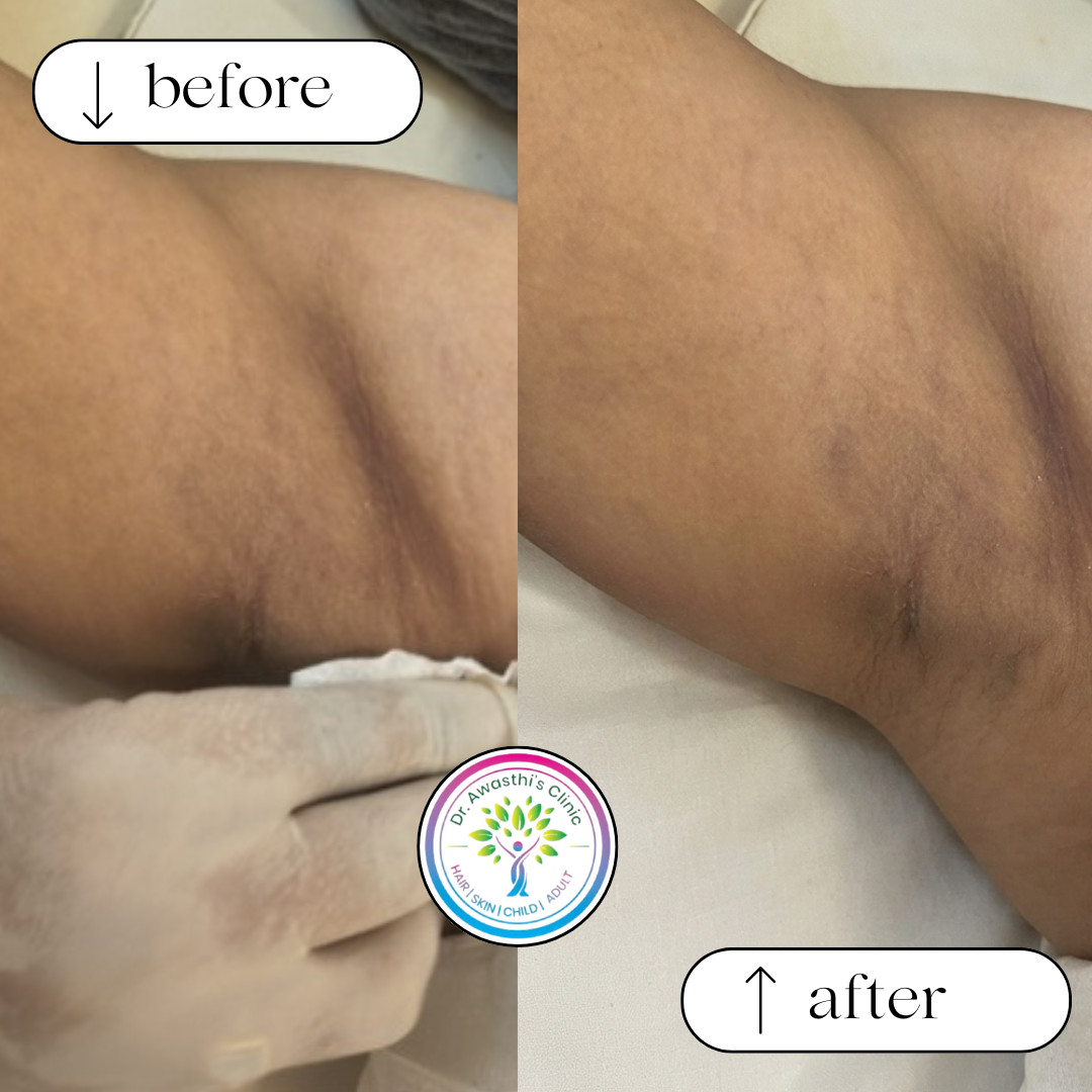 beige white minimalist beauty skincare before after collage instagram post (9)